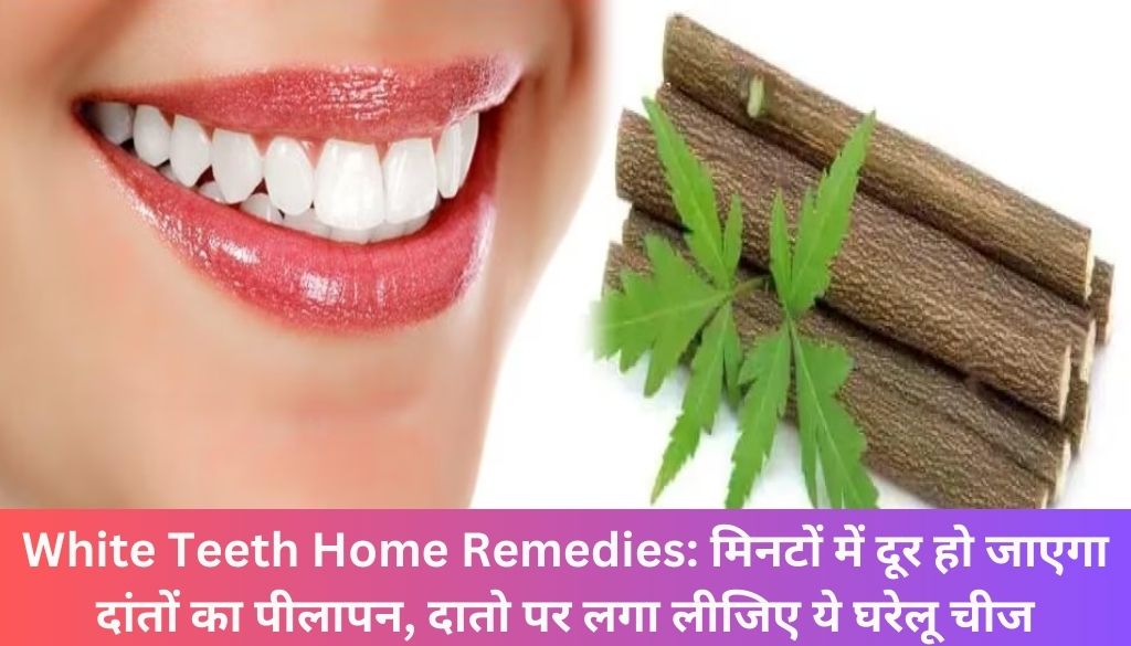 White Teeth Home Remedies: मिनटों में दूर हो जाएगा दांतों का पीलापन, दातो पर लगा लीजिए ये घरेलू चीज